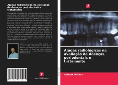 Ajudas radiológicas na avaliação de doenças periodontais e tratamento - Mishra, Ashank