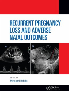 Recurrent Pregnancy Loss and Adverse Natal Outcomes