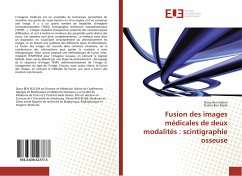 Fusion des images médicales de deux modalités : scintigraphie osseuse - Ben Sellem, Dorra; Ben Rejeb, Naima