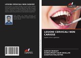 LESIONI CERVICALI NON CARIOSE