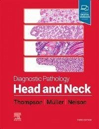 Diagnostic Pathology: Head and Neck - Thompson, Lester D. R.; Müller, Susan; Nelson, Brenda L.