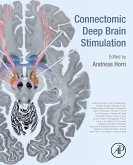 Connectomic Deep Brain Stimulation (eBook, ePUB)