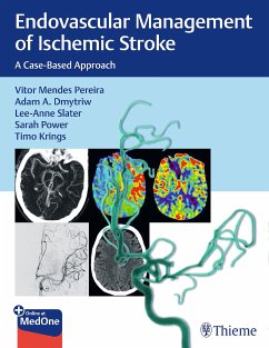 Endovascular Management of Ischemic Stroke (eBook, ePUB) - Pereira, Vitor; Dmytriw, Adam; Slater, Lee-Anne; Power, Sarah; Krings, Timo