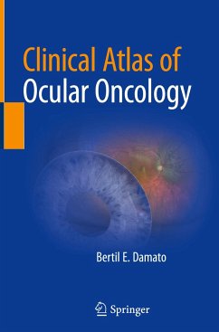 Clinical Atlas of Ocular Oncology - Damato, Bertil E.