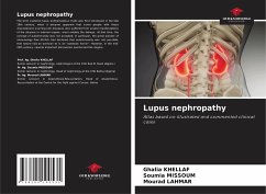 Lupus nephropathy - KHELLAF, Ghalia;MISSOUM, Soumia;Lahmar, Mourad