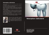 Résorption radiculaire