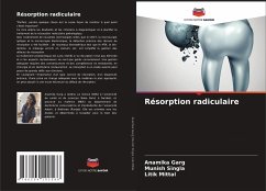 Résorption radiculaire - Garg, Anamika;Singla, Munish;Mittal, Litik