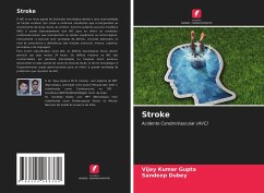 Stroke - Gupta, Vijay Kumar;Dubey, Sandeep