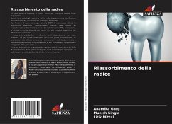 Riassorbimento della radice - Garg, Anamika;Singla, Munish;Mittal, Litik