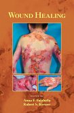 Wound Healing (eBook, ePUB)