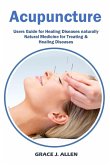Acupuncture Acupuncture