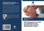 Mikrobiologisches Profil von Infektionen der Brandwunde und des diabetischen Fußes
