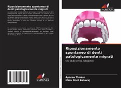 Riposizionamento spontaneo di denti patologicamente migrati - Thakur, Aparna;Baburaj, Mala Dixit