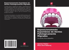 Reposicionamento Espontâneo de Dentes Patologicamente Migrados - Thakur, Aparna;Baburaj, Mala Dixit