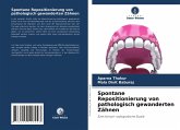 Spontane Repositionierung von pathologisch gewanderten Zähnen