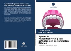 Spontane Repositionierung von pathologisch gewanderten Zähnen - Thakur, Aparna;Baburaj, Mala Dixit