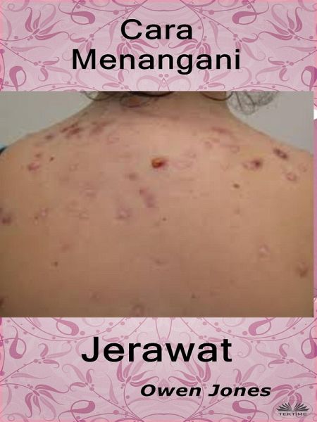 Cara Menangani Jerawat (eBook, ePUB) Cara Menangani Jerawat (eBook, ePUB)