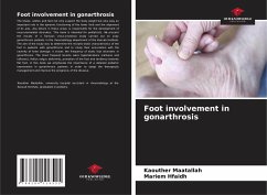 Foot involvement in gonarthrosis - Maatallah, Kaouther;Hfaïdh, Mariem