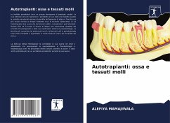 Autotrapianti: ossa e tessuti molli - Mamajiwala, Alefiya