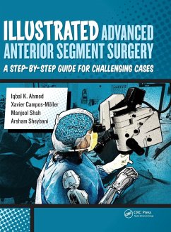 Illustrated Advanced Anterior Segment Surgery - Ahmed, Iqbal; Möller, Xavier; Shah, Manjool