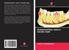 Autoenxertos: osso e tecido mole - Mamajiwala, Alefiya