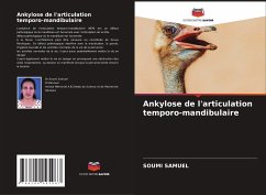 Ankylose de l'articulation temporo-mandibulaire - SAMUEL, SOUMI