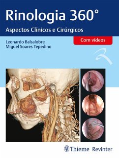 Rinologia 360° (eBook, ePUB) - Balsalobre, Leonardo; Tepedino, Miguel Soares