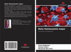 Beta thalassemia major - Mahjoub, Sonia;Ghars, Zeineb;Ben Arfa, Houssem