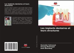 Les implants dentaires et leurs structures - Sehrawat, Harender;Bhatnagar, Anurag;Bhardwaj, Amit