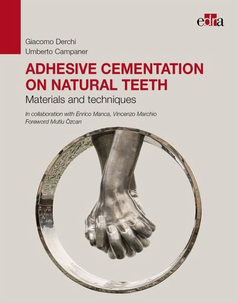 Adhesive Cementation on Natural Teeth. Materials and Techniques Adhesive Cementation on Natural Teeth. Materials and Techniques