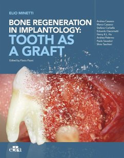 Bone Regeneration in Implantology: Tooth as a Graft - Minetti, Elio; Cusasco, Andrea; Casasco, Marco