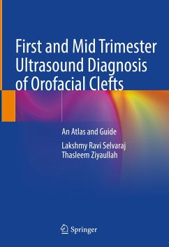 First and Mid Trimester Ultrasound Diagnosis of Orofacial Clefts (eBook, PDF) - Selvaraj, Lakshmy Ravi; Ziyaullah, Thasleem