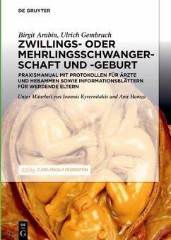 Schwangerschaft, Geburt und Wochenbett von Zwillingen und höhergradigen Mehrlingen (eBook, PDF) - Arabin, Birgit; Gembruch, Ulrich