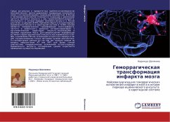 Cover Gemorragicheskaq transformaciq infarkta mozga