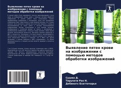 Vyqwlenie pqten krowi na izobrazhenii s pomosch'ü metodow obrabotki izobrazhenij - D., Sushma;N., Tirupati Rao;Bhattachar'q, Debinath