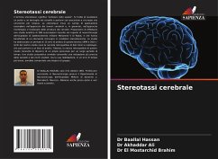 Stereotassi cerebrale - Hassan, Dr Baallal;Ali, Dr Akhaddar;Brahim, Dr El Mostarchid