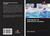 Osteogenesi di distrazione alveolare