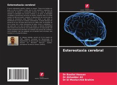 Estereotaxia cerebral - Hassan, Dr Baallal;Ali, Dr Akhaddar;Brahim, Dr El Mostarchid