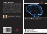 Cerebral stereotaxis