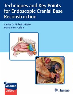 Techniques and Key Points for Endoscopic Cranial Base Reconstruction (eBook, ePUB) - Pinheiro-Neto, Carlos; Peris-Celda, Maria