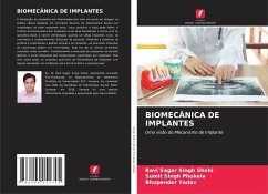 BIOMECÂNICA DE IMPLANTES - Singh Shahi, Ravi Sagar;Singh Phukela, Sumit;Yadav, Bhupender