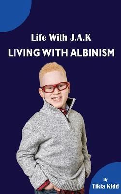 Life With J.A.K Living with Albinism (eBook, ePUB)