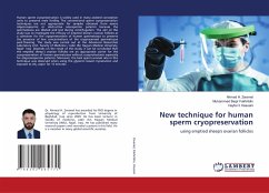 New technique for human sperm cryopreservation - Zwamel, Ahmed H.;Fakhrildin, Muhammed Baqir;Hassani, Hayfa H.