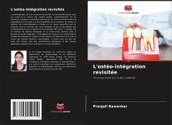 L'ostéo-intégration revisitée - Bawankar, Pranjali