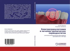 Jelektrogranulotomiq w lechenii hronicheskih periodontitow - Shishkina, Oxana; Semennikow, Vladimir