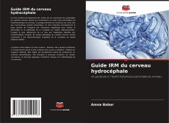 Guide IRM du cerveau hydrocéphale - Babar, Amna