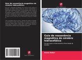 Guia de ressonância magnética do cérebro hidrocefálico