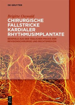 Chirurgische Fallstricke kardialer Rhythmusimplantate (eBook, ePUB) - Osswald, Brigitte