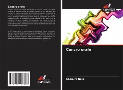 Cancro orale - Naik, Shamira