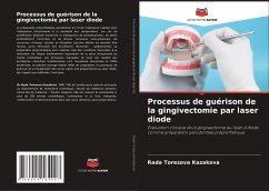 Processus de guérison de la gingivectomie par laser diode - Kazakova, Rada Torezova